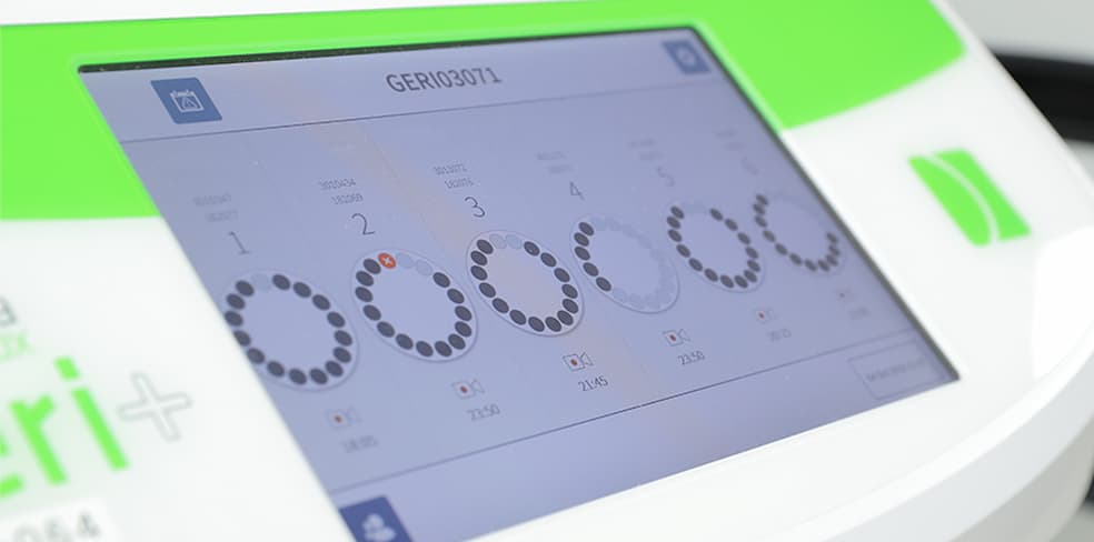 AI機能を搭載したタイムラプスインキュベータ Geriジェリ（メルクセローノ社）